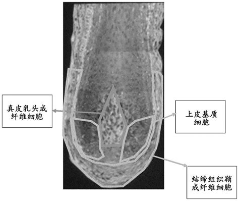 乳頭 長毛|乳头毛